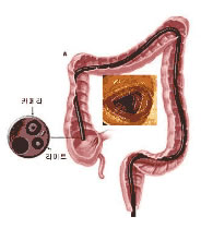 대장내시경검사
