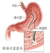 위내시경검사